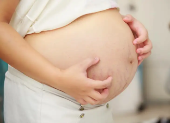 Nguyên nhân, phòng tránh & cách chữa trị rạn da khi mang thai